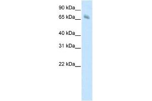KBTBD10 antibody (20R-1206) used at 0. (Kelch-like protein 41 (KLHL41) (C-Term) 抗体)