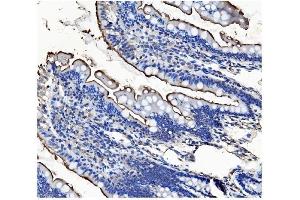 IHC analysis of CD13/ANPEP using anti-CD13/ANPEP antibody (ABIN7600089).
