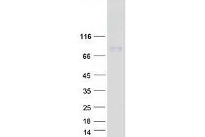 Western Blotting (WB) image for Amiloride-Sensitive Cation Channel 4, Pituitary (ACCN4) (Transcript Variant 1) protein (Myc-DYKDDDDK Tag) (ABIN2716042)