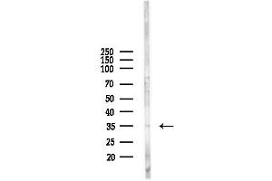 anti-Thioredoxin-Related Transmembrane Protein 2 (TMX2) (N-Term) antibody
