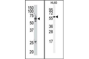 Image no. 1 for anti-SUMO1/sentrin/SMT3 Specific Peptidase 2 (SENP2) (C-Term) antibody (ABIN356752) (SENP2 抗体  (C-Term))
