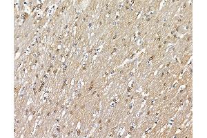 ABIN6264451 and ABIN6279641 at 1/100 staining rat brain tissue by IHC-P. (PRRX2 抗体  (Internal Region))