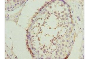 Immunohistochemistry of paraffin-embedded human testis tissue using ABIN7171132 at dilution of 1:100 (SYCE1 抗体  (AA 132-351))