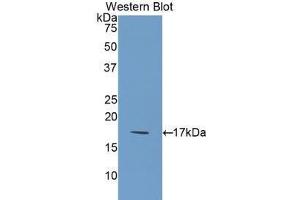 Western blot analysis of the recombinant protein. (FIL1d 抗体  (AA 12-151))