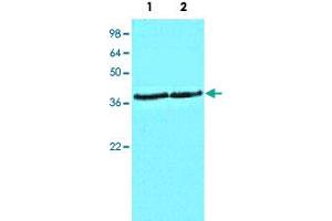 Cell lysates of HeLa (Lane 1) and MCF-7 (Lane 2) (40 ug/lane) were resolved by SDS-PAGE, transferred to NC membrane and probed with CSNK1A1 monoclonal antibody, clone AT2E2  (1 : 1000). (CSNK1A1 抗体)