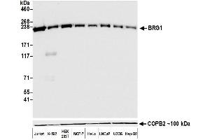 Western Blotting (WB) image for anti-SWI/SNF Related, Matrix Associated, Actin Dependent Regulator of Chromatin, Subfamily A, Member 4 (SMARCA4) (AA 75-125) antibody (ABIN7453997)