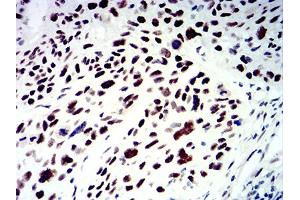 Immunohistochemistry (IHC) image for anti-SWI/SNF Related, Matrix Associated, Actin Dependent Regulator of Chromatin, Subfamily A, Member 1 (SMARCA1) (AA 933-1070) antibody (ABIN5611352)