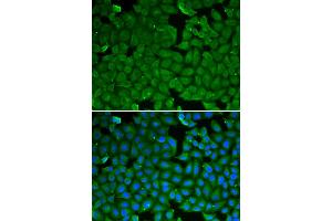 Immunofluorescence analysis of HeLa cells using SPINK1 antibody. (SPINK1 抗体)