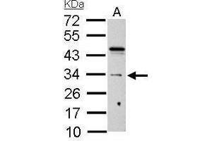 WB Image HUS1 antibody detects HUS1 protein by Western blot analysis. (HUS1 抗体  (Center))