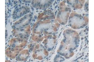 DAB staining on IHC-P; Samples: Human Stomach Tissue (FLG2 抗体  (AA 1915-2143))