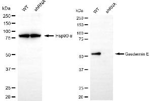 Western blotting analysis using gasdermin E antibody (ABIN7799622). (Recombinant Non-Syndromic Hearing Impairment Protein 5 (GSDME) 抗体)