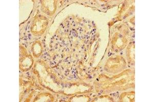 Immunohistochemistry of paraffin-embedded human kidney tissue using ABIN7148641 at dilution of 1:100 (NR2F2 抗体  (AA 123-383))