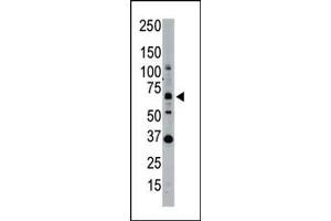 Western blot analysis of SENP1 polyclonal antibody  in whole HL60 cell lysate: SENP1 (Arrow) was detected using purified Pab. (SENP1 抗体  (N-Term))