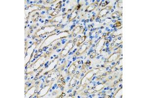 Immunohistochemistry (Paraffin-embedded Sections) (IHC (p)) image for anti-Coatomer Protein Complex, Subunit beta 2 (COPB2) (AA 657-906) antibody (ABIN6138871)