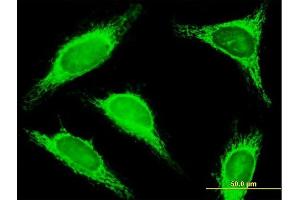 Immunofluorescence of purified MaxPab antibody to TRDD3 on HeLa cell. (TRDD3 抗体  (AA 1-296))