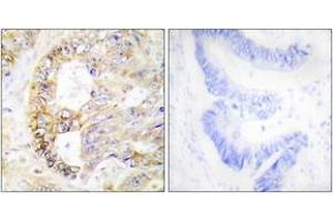 Immunohistochemistry analysis of paraffin-embedded human colon carcinoma tissue, using COX41 Antibody. (COX IV 抗体  (AA 11-60))