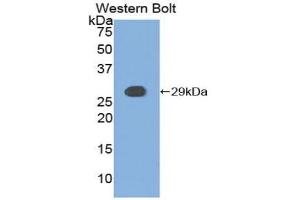 Western blot analysis of the recombinant protein. (CSNK1A1 抗体  (AA 114-324))