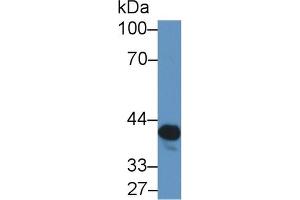 Detection of NAT2 in Rat Serum using Polyclonal Antibody to N-Acetyltransferase 2 (NAT2) (NAT2 抗体  (AA 20-280))