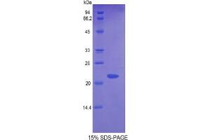 SDS-PAGE analysis of Mouse Glyoxalase I Protein. (GLO1 蛋白)