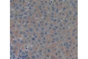 Used in DAB staining on fromalin fixed paraffin- embedded liver tissue (TNKS2 抗体  (AA 959-1166))