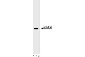 Western Blotting (WB) image for anti-Tumor Protein P53 (TP53) antibody (ABIN967409) (p53 抗体)