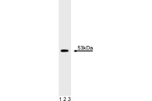 Western Blotting (WB) image for anti-Tumor Protein P53 (TP53) antibody (ABIN967409)