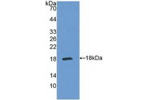 Detection of Recombinant IL5Ra, Human using Polyclonal Antibody to Interleukin 5 Receptor Alpha (IL5Ra) (IL5RA 抗体  (AA 42-182))