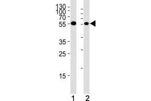 Chk1 antibody western blot analysis in (1) HeLa cell line and (2) mouse thymus tissue lysate