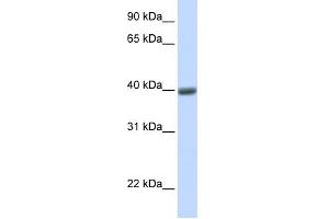 MAGEA1 antibody used at 1 ug/ml to detect target protein. (MAGEA1 抗体)