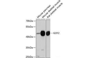 Western blot analysis of extracts of various cell lines using GDF2 Polyclonal Antibody at dilution of 1:1000. (GDF2 抗体)