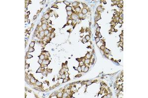 Immunohistochemistry of paraffin-embedded rat testis using GARS Rabbit pAb (ABIN6127942, ABIN6140964, ABIN6140966 and ABIN6221085) at dilution of 1:300 (40x lens). (GARS 抗体  (AA 60-370))