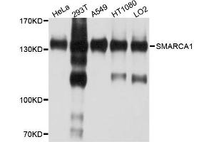 Western blot analysis of extract of various cells, using SMARCA1 antibody. (SMARCA1 抗体)