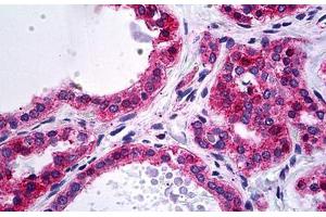 Human Thyroid: Formalin-Fixed, Paraffin-Embedded (FFPE) (alpha Actinin 4 抗体  (AA 592-702))