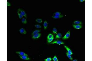 Immunofluorescent analysis of HepG2 cells using ABIN7155160 at dilution of 1:100 and Alexa Fluor 488-congugated AffiniPure Goat Anti-Rabbit IgG(H+L) (HIGD1B 抗体  (AA 1-29))
