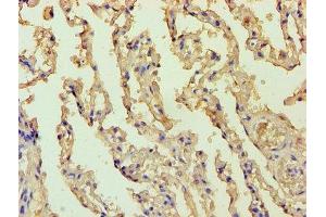 Immunohistochemistry of paraffin-embedded human lung tissue using ABIN7145166 at dilution of 1:100 (Cyclin D1 抗体  (AA 1-233))