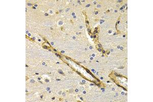Immunohistochemistry of paraffin-embedded rat brain using KLKB1 antibody at dilution of 1:200 (400x lens). (KLKB1 抗体)