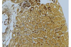 ABIN6273039 at 1/100 staining Mouse kidney tissue by IHC-P. (D2HGDH 抗体  (C-Term))
