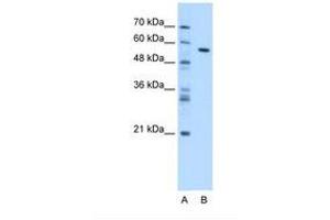 Image no. 1 for anti-Carboxylesterase 1 (CES1) (AA 33-82) antibody (ABIN320684)