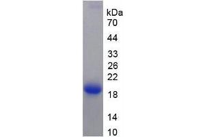 SDS-PAGE analysis of Rat Keratin 12 Protein. (KRT12 蛋白)