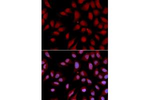 Immunofluorescence analysis of U2OS cells using DLGAP5 antibody. (DLGAP5 抗体)