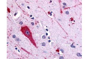 Immunohistochemical (Formalin/PFA-fixed paraffin-embedded sections) staining in human brain (cortex) with HTR5A polyclonal antibody . (Serotonin Receptor 5A 抗体)