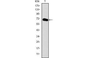 Western blot analysis using GATA5 mAb against human GATA5 (AA: 168-391) recombinant protein. (GATA5 抗体)