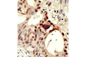 Image no. 1 for anti-DNA (Cytosine-5-)-Methyltransferase 3 Like (TRDMT1) (AA 388-417), (C-Term) antibody (ABIN356577) (DNMT3L 抗体  (C-Term))