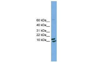 WB Suggested Anti-PPIH Antibody Titration: 0. (PPIH 抗体  (Middle Region))