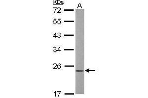 WB Image Sample (50 ug of whole cell lysate) A: mouse liver 12% SDS PAGE antibody diluted at 1:1000 (RAC1 抗体  (Center))