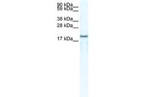 WB Suggested Anti-CXCL14 Antibody Titration:  1 ug/ml  Positive Control:  HepG2 cell lysate