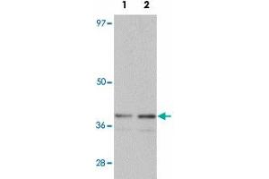 Western blot analysis of SLC39A1 in mouse kidney tissue lysate with SLC39A1 polyclonal antibody  at (1) 1 and (2) 2 ug/mL. (SLC39A1 抗体  (N-Term))