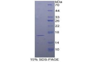 SDS-PAGE analysis of Human TCL1A Protein. (TCL1A 蛋白)