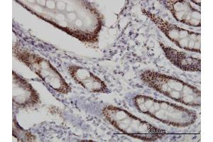 Immunoperoxidase of monoclonal antibody to WDR4 on formalin-fixed paraffin-embedded human small Intestine. (WDR4 抗体  (AA 1-266))