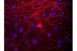 View of mixed neuron/glial cultures stained with NEFM / NF-M antibody (red). (NEFM 抗体)